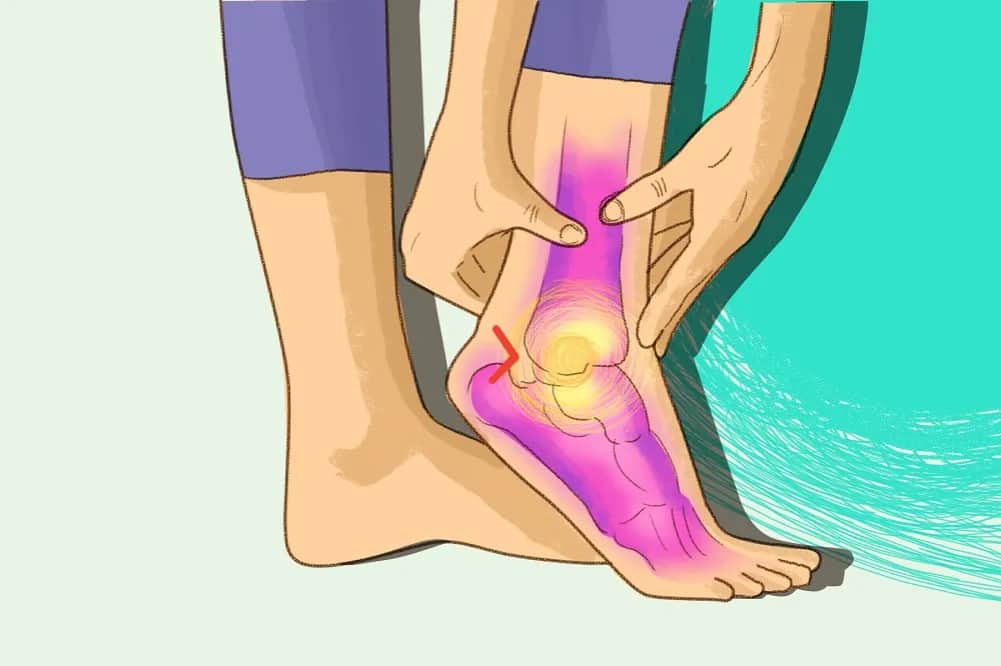 Skręcona kostka: Co robić po urazie? Od objawów do pełnej sprawności